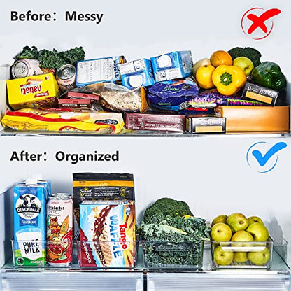  Efrigerator Organizer Bins, REDMOND 6pcs Fridge Organizers And Storage Clear Stackable For Kitchen, Pantry, Refrigerator, Cabinets, Freezer (2 Small+2 Medium+2 Large)